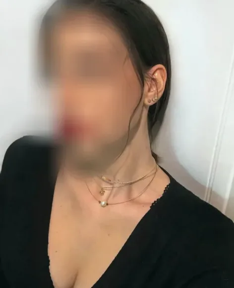 Ayse, 25